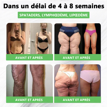 𝑩𝒐𝒖𝒕𝒊𝒒𝒖𝒆 𝑶𝒇𝒇𝒊𝒄𝒊𝒆𝒍𝒍𝒆 | 𝗘𝗤𝗩𝗣® 𝐺𝐿𝑃-𝟏 𝑺𝒐𝒍𝒖𝒕𝒊𝒐𝒏 𝑶𝒓𝒂𝒍𝒆 𝑺𝒊𝒙-𝒊𝒏-𝑶𝒏𝒆 𝑷𝒐𝒖𝒓 𝒍𝒂 𝑺𝒂𝒏𝒕𝒆 ✅ 𝐏𝐨𝐮𝐫 𝐥’𝐨𝐛𝐞́𝐬𝐢𝐭𝐞́, 𝐥𝐚 𝐬𝐚𝐧𝐭𝐞́ 𝐜𝐚𝐫𝐝𝐢𝐨𝐯𝐚𝐬𝐜𝐮𝐥𝐚𝐢𝐫𝐞, 𝐥𝐞 𝐝𝐢𝐚𝐛𝐞̀𝐭𝐞, 𝐥’𝐚𝐩𝐧𝐞́𝐞 𝐝𝐮 𝐬𝐨𝐦𝐦𝐞𝐢𝐥, 𝐥𝐚 𝐬𝐚𝐧𝐭𝐞́ 𝐢𝐧𝐭𝐞𝐬𝐭𝐢𝐧𝐚𝐥𝐞, 𝐥𝐞𝐬 𝐩𝐫𝐨𝐛𝐥𝐞̀𝐦𝐞𝐬 𝐚𝐫𝐭𝐢𝐜𝐮𝐥𝐚𝐢𝐫𝐞𝐬 𝐞𝐭 𝐛𝐢𝐞𝐧 𝐩𝐥𝐮𝐬 🐨